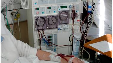 Dialysis in action. 