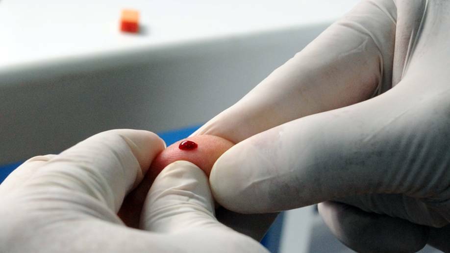 Prevention, testing and treatment: The key to HIV elimination