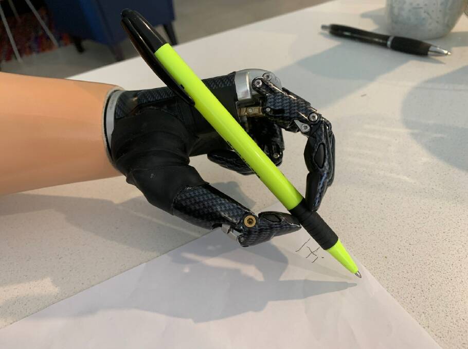 SUPPORT: Korina can now write with her new bionic hands. Photo: supplied. 