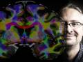 3D BRAIN ATLAS: Neurobiologist Dr Mark Schira from the University of Wollongong's School of Psychology, is on quest to finally map the living human brain and its more than 1000 known structures with the use of magnetic resonance imaging (MRI). Picture: Paul Jones